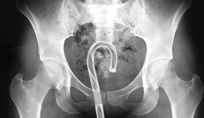 En İlginç ve Şaşırtıcı Röntgen Görüntüleri